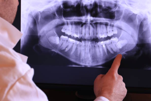 Best Emergency Tooth Extraction in New Hope, AL