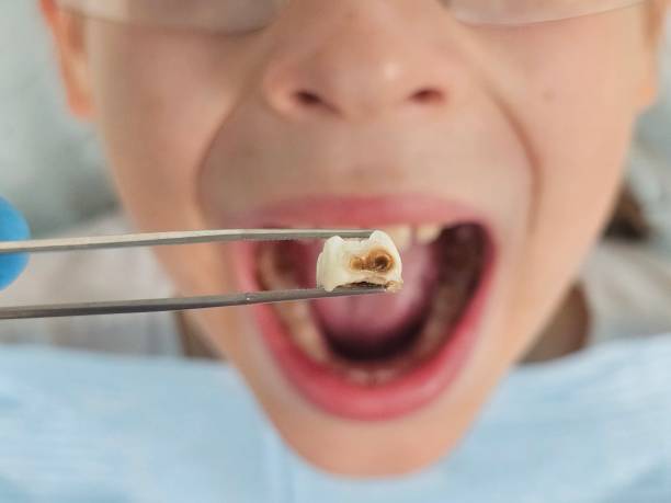 Best Emergency Dental Care for Trauma or Injury in New Hope, AL